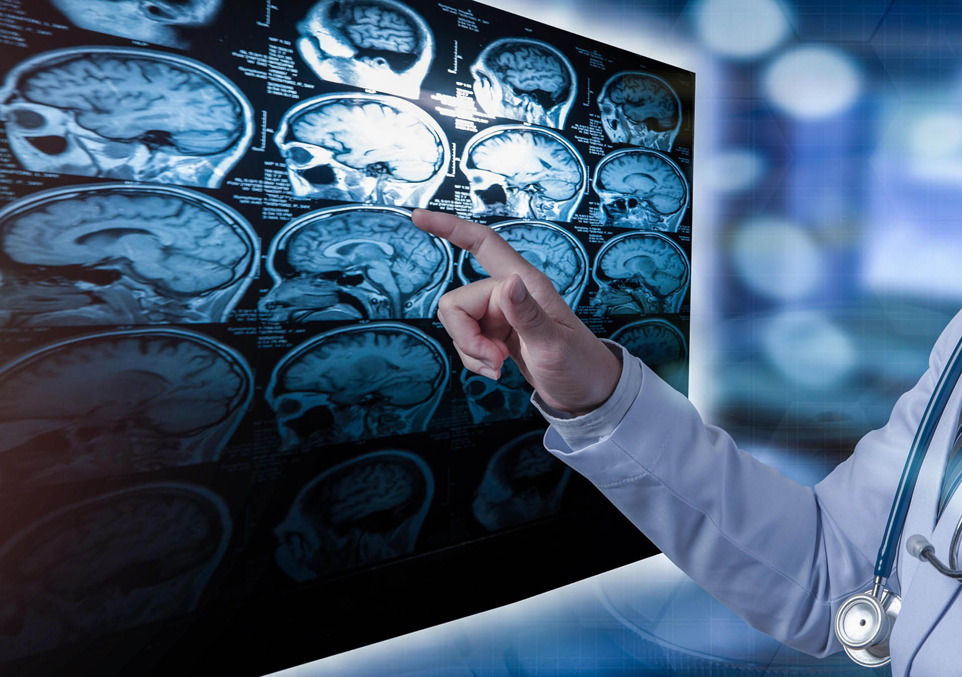 neurology-kims